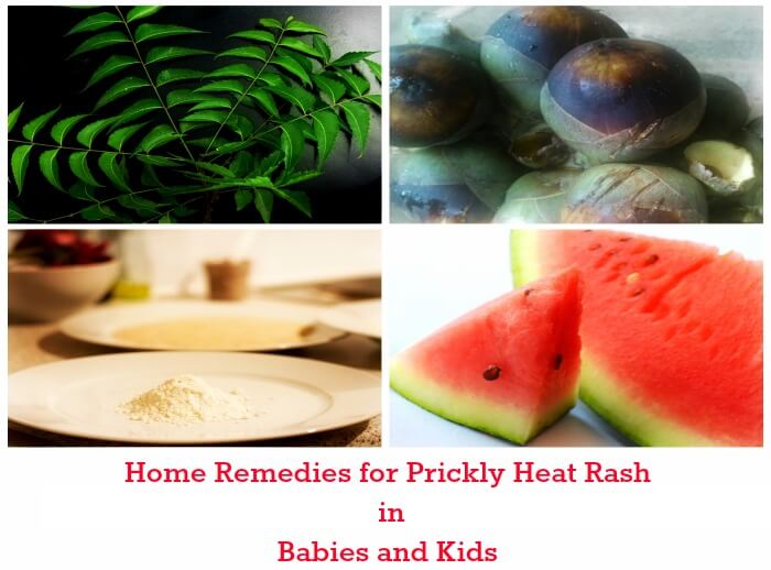 11 Ways to Get Rid of Prickly Heat Rash Once and For All